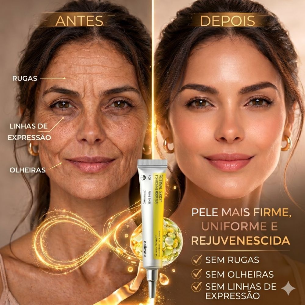 Antes e Depois Rugas e Linhas